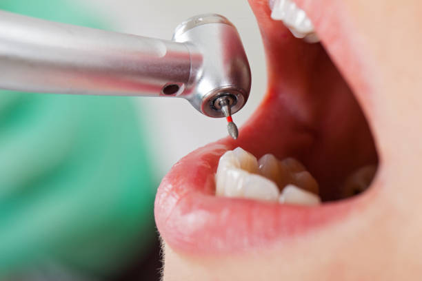 Best Emergency Dental Services for Seniors in East Shoreham, NY